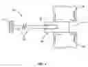 Fig. 02 - Adjustable insertion device for a vertebral implant