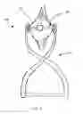 Fig. 02 - Knee surgery method and apparatus