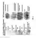 Fig. 03 - Methods and compositions for treating motor neuron associated disorders