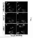 Fig. 04 - Methods and compositions for treating motor neuron associated disorders