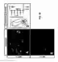 Fig. 11 - Methods and compositions for treating motor neuron associated disorders