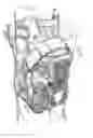 Fig. 04 - Knee pad constructions