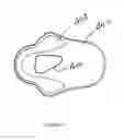 Fig. 12 - Knee pad constructions