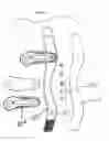 Fig. 14 - Knee pad constructions