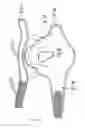 Fig. 19 - Knee pad constructions