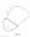 Fig. 03 - Scrotal catch