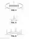 Fig. 04 - Handle and method of manufacture
