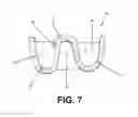 Fig. 05 - Handle and method of manufacture