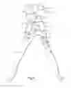 Fig. 04 - POWER SCISSORS WITH EXTRA LARGE MOUTH