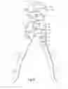 Fig. 05 - POWER SCISSORS WITH EXTRA LARGE MOUTH