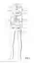Fig. 06 - POWER SCISSORS WITH EXTRA LARGE MOUTH
