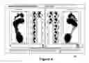 Fig. 05 - Method for Design and Manufacture of Insoles