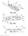 Fig. 04 - Attachments for an item of footwear