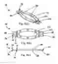 Fig. 05 - Attachments for an item of footwear