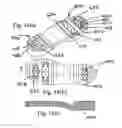 Fig. 14 - Attachments for an item of footwear