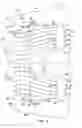 Fig. 05 - Gas turbine engine inlet with noise reduction features