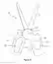 Fig. 03 - Decorative scissor handles and method for manufacturing decorative scissor handles