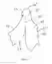 Fig. 10 - Decorative scissor handles and method for manufacturing decorative scissor handles