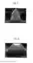Fig. 04 - Process for selective masking of III-N layers and for the preparation of free-standing III-N layers or of devices, and products obtained thereby