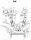 Fig. 02 - Variable valve actuation mechanism for an internal combustion engine