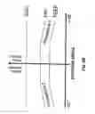 Fig. 10 - Method and apparatus for controlling at least one ventilation parameter of an artificial ventilator for ventilating the lung of a patient in accordance with a plurality of lung positions