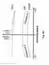 Fig. 11 - Method and apparatus for controlling at least one ventilation parameter of an artificial ventilator for ventilating the lung of a patient in accordance with a plurality of lung positions