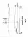 Fig. 12 - Method and apparatus for controlling at least one ventilation parameter of an artificial ventilator for ventilating the lung of a patient in accordance with a plurality of lung positions