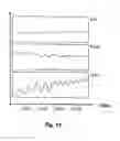 Fig. 15 - Method and apparatus for controlling at least one ventilation parameter of an artificial ventilator for ventilating the lung of a patient in accordance with a plurality of lung positions