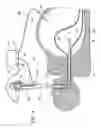 Fig. 05 - Method for accessing abdominal cavity and medical procedure via natural orifice
