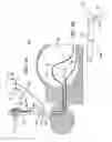 Fig. 10 - Method for accessing abdominal cavity and medical procedure via natural orifice