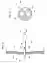 Fig. 22 - Method for accessing abdominal cavity and medical procedure via natural orifice