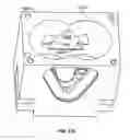 Fig. 21 - Portable ventilator system