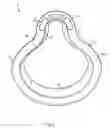 Fig. 09 - Patient interface device with dampening cushion
