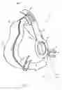 Fig. 13 - Patient interface device with dampening cushion