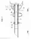 Fig. 02 - Overtube