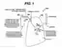 Fig. 02 - Variable resistance pulmonary ventilation bypass valve and method