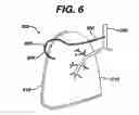 Fig. 05 - Variable resistance pulmonary ventilation bypass valve and method