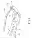 Fig. 05 - Barrette