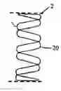 Fig. 01 - Method of forming a non-circular stent