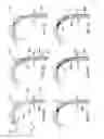 Fig. 08 - Method of forming a non-circular stent