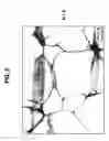 Fig. 06 - Titanium alloy of low Young's modulus