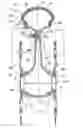 Fig. 01 - Vehicle wheel with easily accessible inflation valve