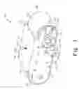 Fig. 02 - Vacuum traction device
