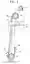 Fig. 02 - Rotary bar screen device