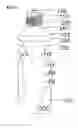 Fig. 09 - Push-pull cap a bottle and a bottle having the push-pull cap