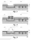 Fig. 02 - Planarization with reduced dishing