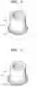 Fig. 04 - Case for portable electronic device