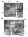 Fig. 07 - Optical equipment mounting devices and systems
