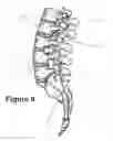 Fig. 06 - FLEXIBLE SPINAL DISC