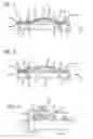 Fig. 02 - Pressurized molding of composite parts